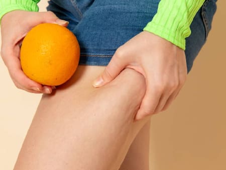 Elimina la celulitis de tus piernas de manera 100% natural