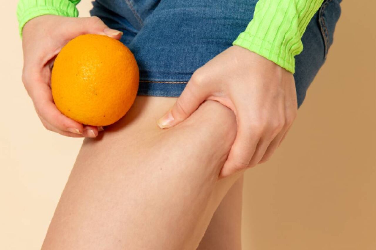 Mujer en short y naranja en mano señalando la celulitis de sus piernas.