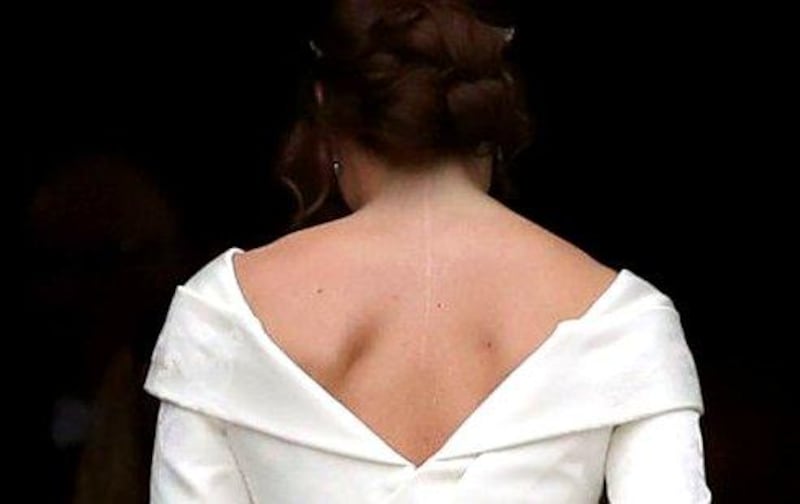 La princesa Eugenia mostrando con orgullo su cicatriz en su traje de bodas