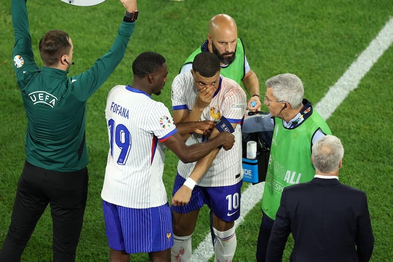 Lesión de Kylian Mbappé en la Eurocopa